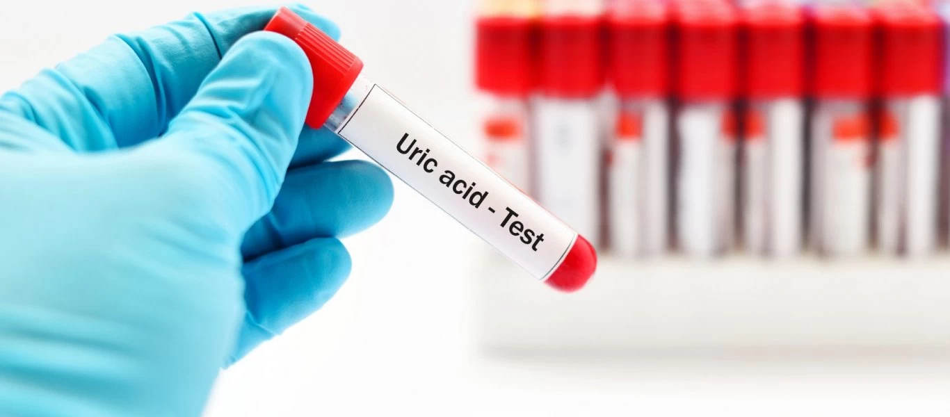 Ουρικό οξύ: Αιτίες, συμπτώματα και αντιμετώπιση